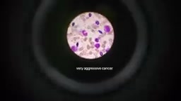 Amanda's cancer journey