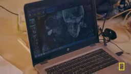 X-ray scanning used to analyze the sex of a mummy