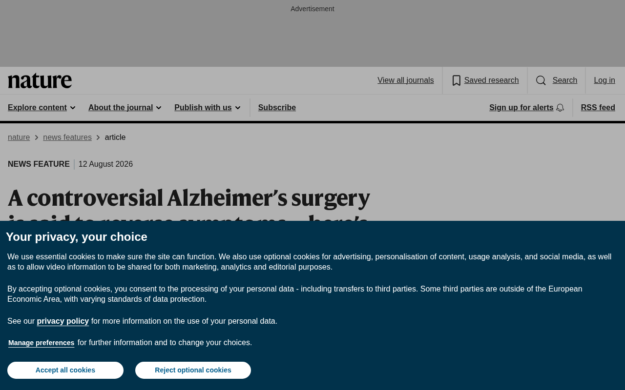 Can Neck Lymphatic Surgery Reverse Alzheimer's? Analyzing the Scientific Hypothesis and Controversy
