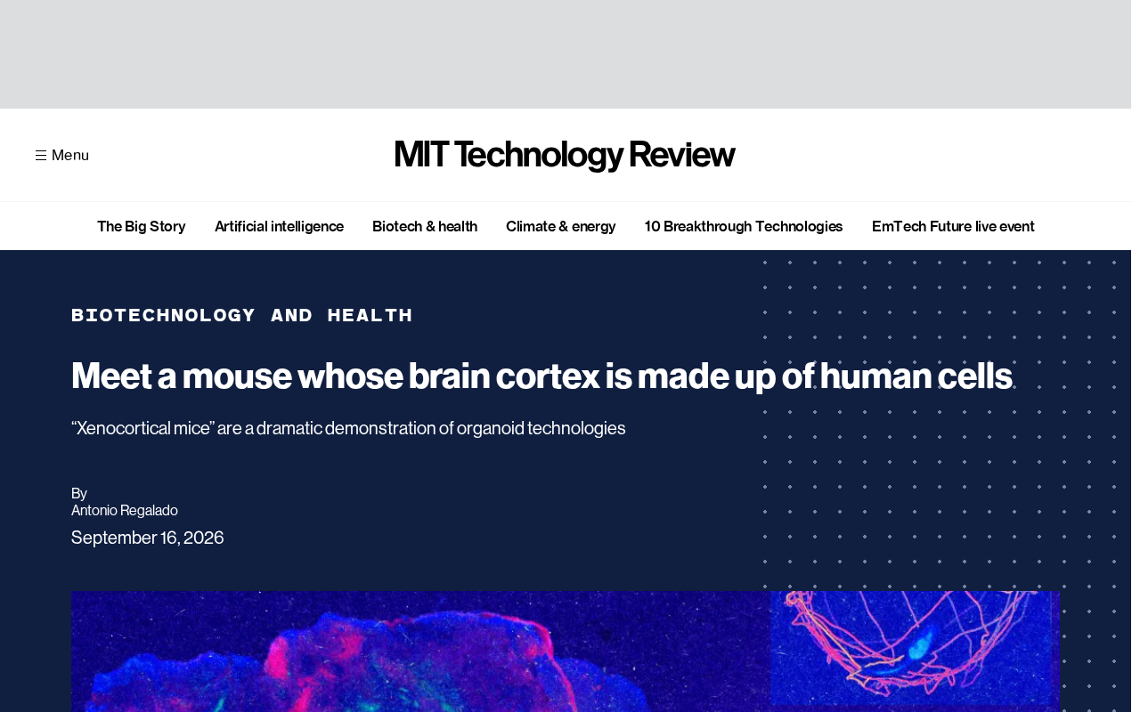 Half a Brain Built from Human Cells: The Science Behind Chimeric Mice