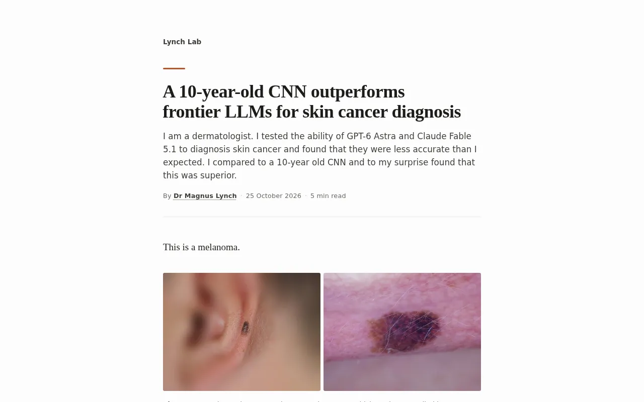 A 10-Year-Old CNN Beats Frontier LLMs at Detecting Skin Cancer